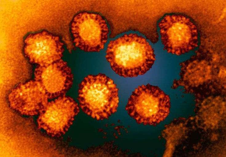 Исследование на арбовирусные инфекции (Вирус Западного Нила)